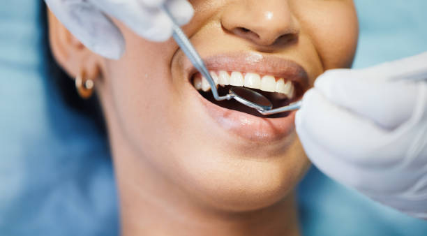 Best Broken or Cracked Tooth Emergency Dentist in Hurstbourne Acres, KY