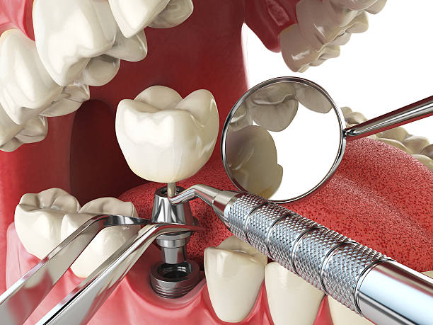 Best Emergency Root Canal Treatment in Hurstbourne Acres, KY